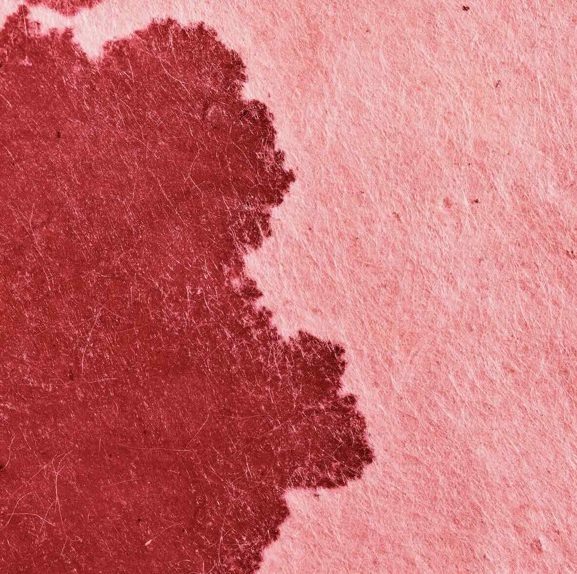 幸せな毒娘  Vol.61  女性と動物：優先されるのは誰の権利か